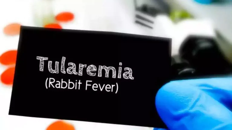 What are the Reasons for the Spread of Rabbit Fever? Know its Symptoms and Prevention